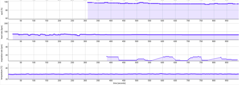 Movement Vital Signs